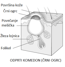 Črni ogrc