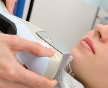 ženska na terapiji z laserjem za odstranjevanje mozoljev