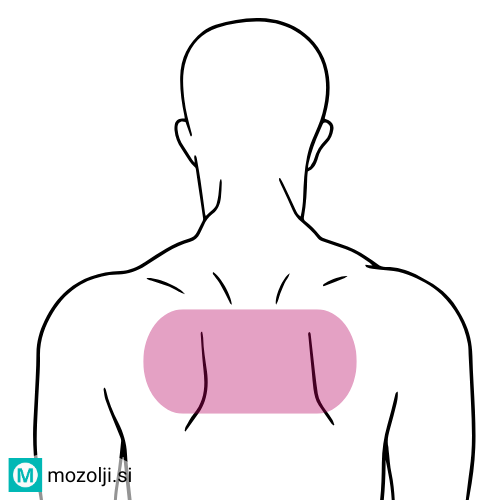 oseba z aknami na hrbtu