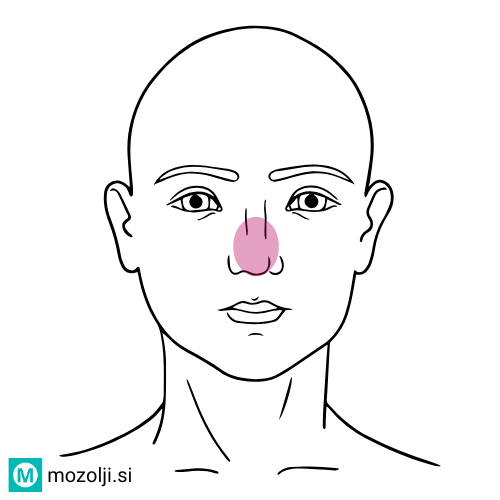 oseba z aknami in ogrci na nosu